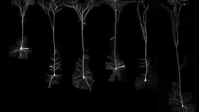 Caption:MIT neuroscientists analyzed neurons from several different species.