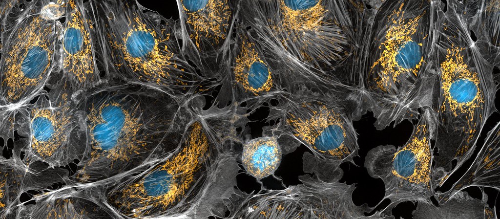 mitochondria