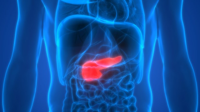pancreatic cancer
