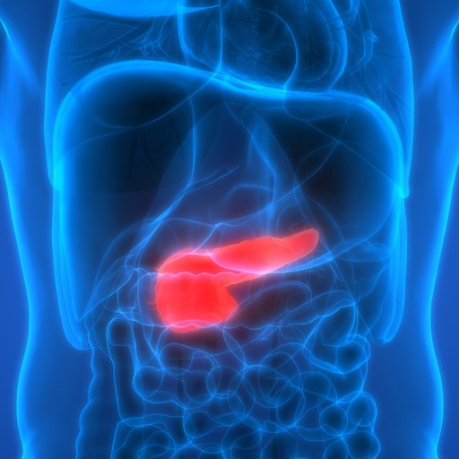 pancreatic cancer