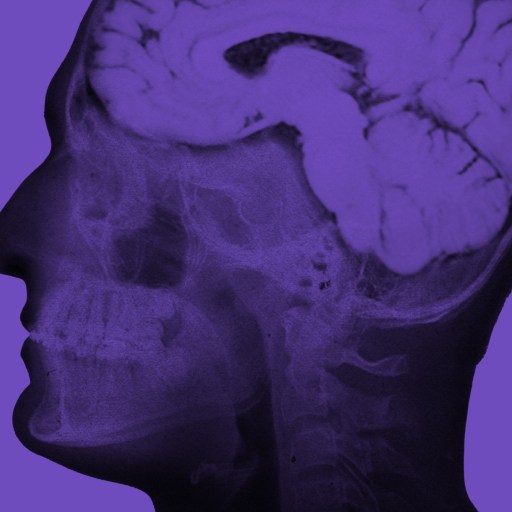 Side view X-ray image of a human head and brain in shades of purple, shown against a solid purple background, highlighting the serene focus often seen in meditators.