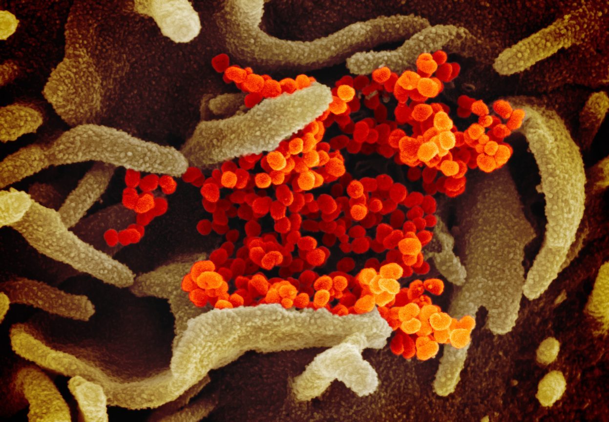 Respiratory illnesses, such as these novel coronavirus particles, may be a cause of SIDS.