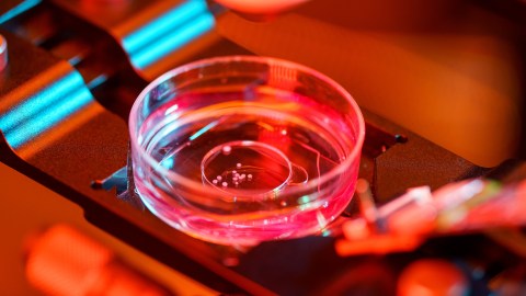 brain organoid