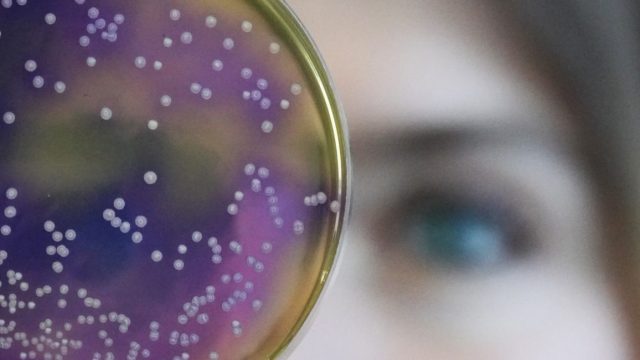 yeast cell colony humans