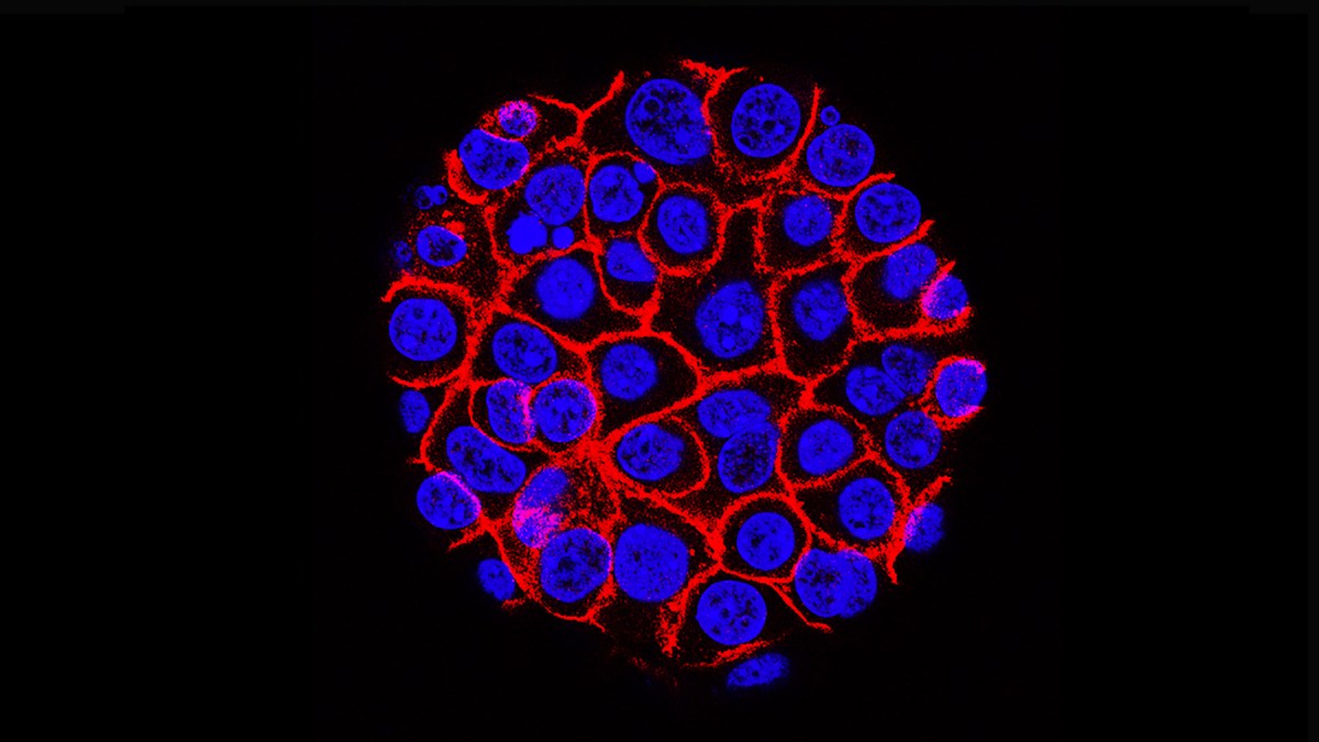 An image of a pancreatic cell in a dark room.