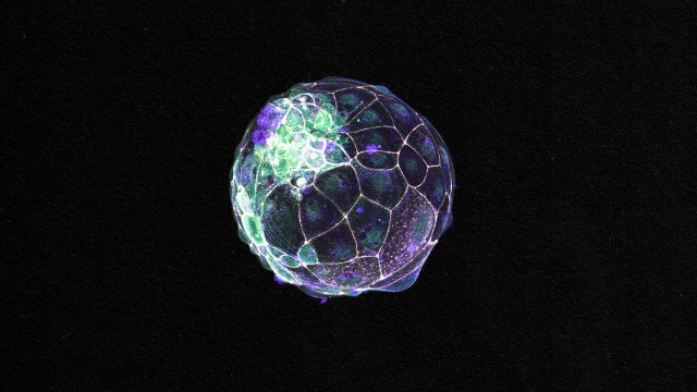 A blastoid.