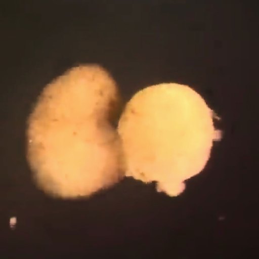Two spherical, yellowish biological structures are positioned side by side against a dark background.