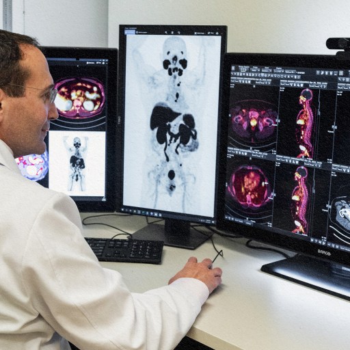 A man in a white coat is analyzing positron emissions on two monitors.