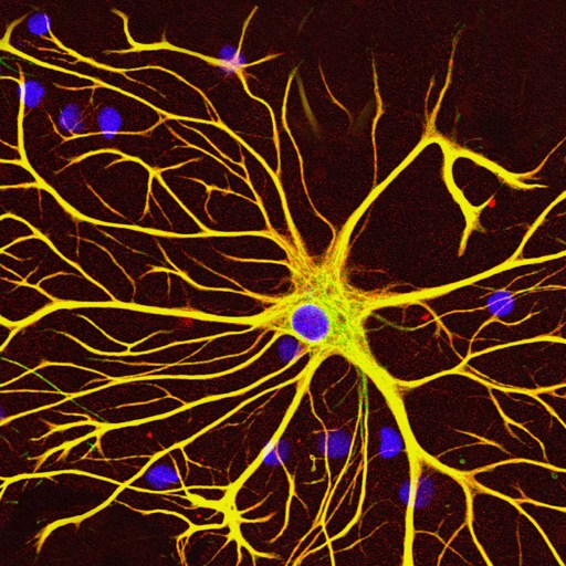 An image of a new neuron with blue and yellow lights.