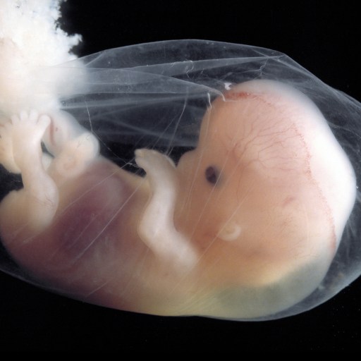 An image of a fetus in an incubator, showcasing the delicate growth process.