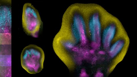 Fingers forming in the womb