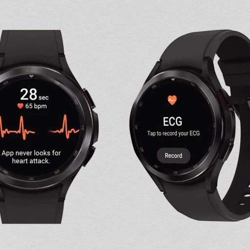 Xiaomi redmi note 3 smartwatch with blood pressure device integration.