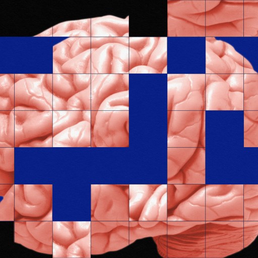 An image of a brain exhibiting the tetris effect.