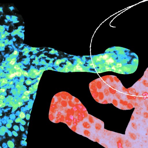 An image of a man punching a ball.