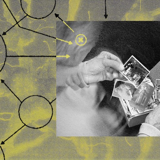 Hands sifting through a collection of black and white photographs against an abstract artistic backdrop, each image reminiscent of treatments for Alzheimer's.