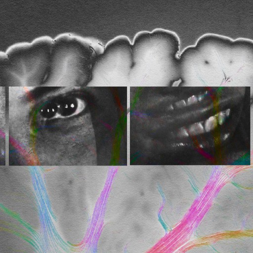 A black and white photo of a person's brain.