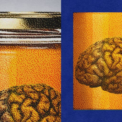 An image of a glass jar containing a brain on a textured background.