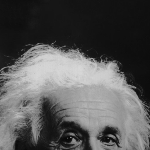 Black and white close-up photograph showing the upper part of an elderly person’s face and their white, unruly hair against a dark background.