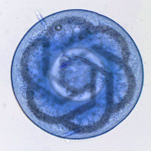 Microscopic view of a translucent, spiral-shaped Trichinella spiralis larva within a blue-stained muscle tissue.