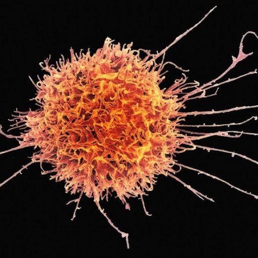 Orange spherical cell with elongated extensions against a black background.