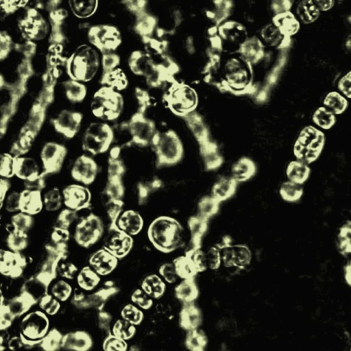 Microscopic view of green cyanobacteria chains forming spiral and linear patterns against a dark background, highlighting their role within the microbiome.