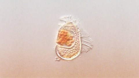 Microscopic view of a single-celled organism with a translucent body and clustered orange structures inside, set against a plain background.