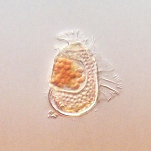 Microscopic view of a single-celled organism with a translucent body and clustered orange structures inside, set against a plain background.