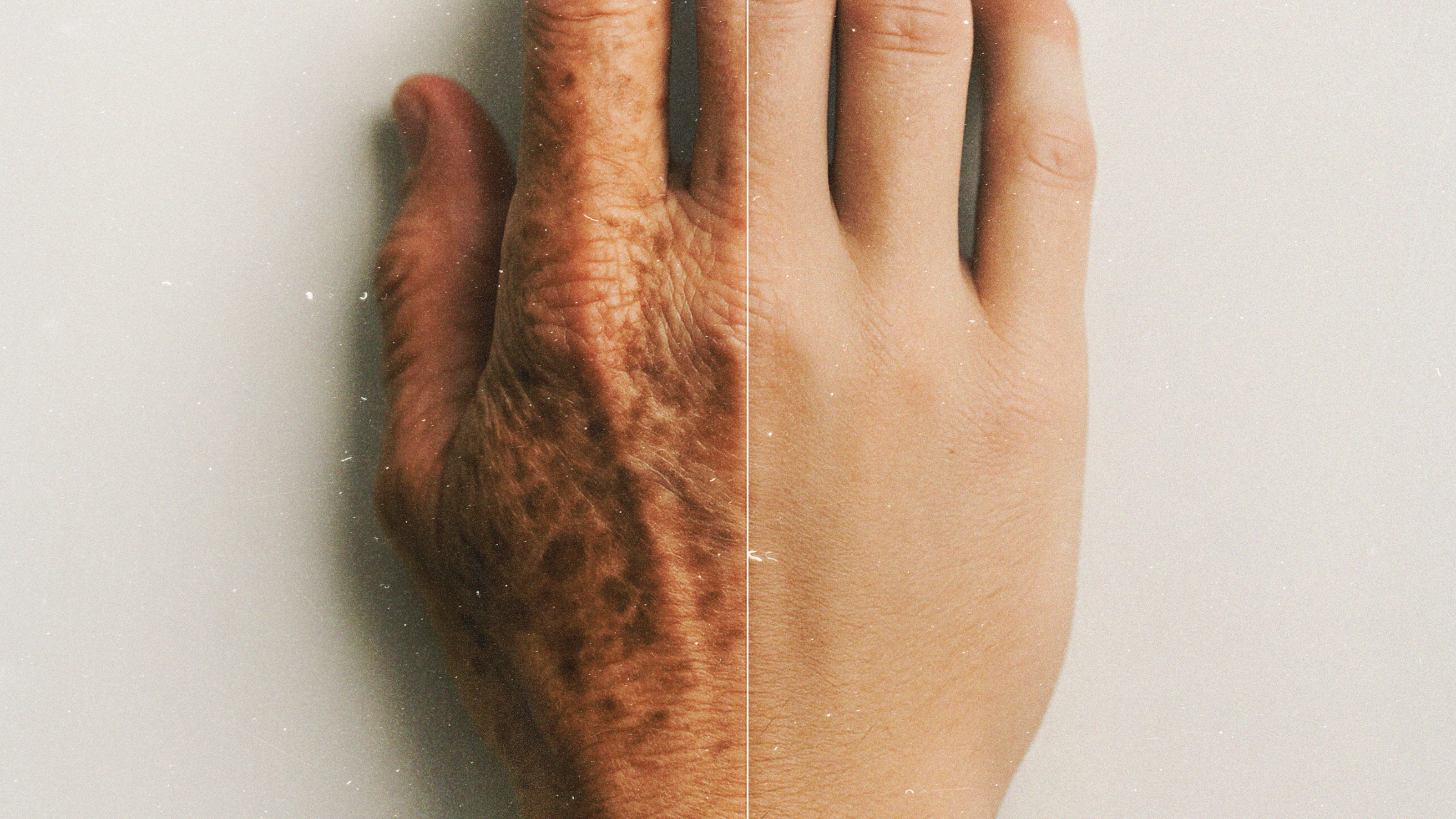 A close up of a hand.
