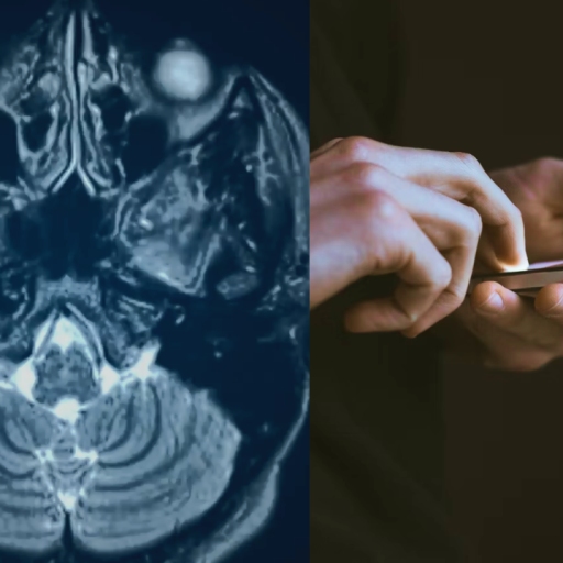 A split image showing a brain scan on the left and hands using a smartphone on the right.